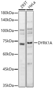 DYRK1A Antibody in Western Blot (WB)