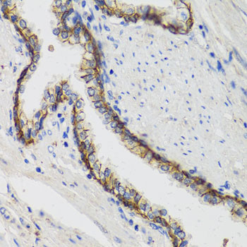 ATP1A1 Antibody in Immunohistochemistry (Paraffin) (IHC (P))