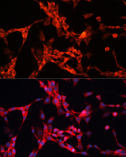 GSK3 alpha Antibody in Immunocytochemistry (ICC/IF)