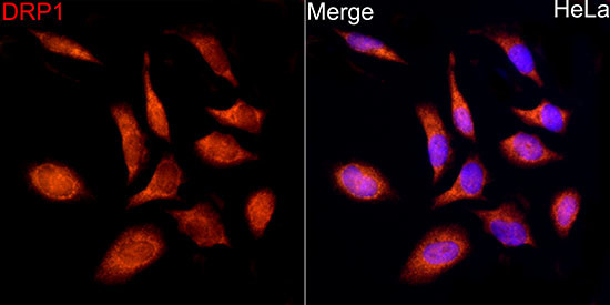 DNM1L Antibody in Immunocytochemistry (ICC/IF)