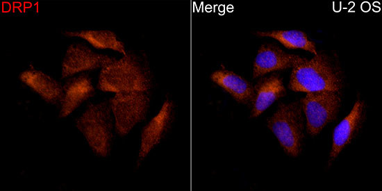 DNM1L Antibody in Immunocytochemistry (ICC/IF)