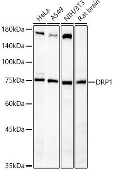 DNM1L Antibody in Western Blot (WB)