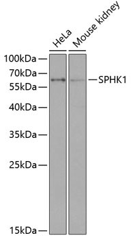 SPHK1 Antibody in Western Blot (WB)