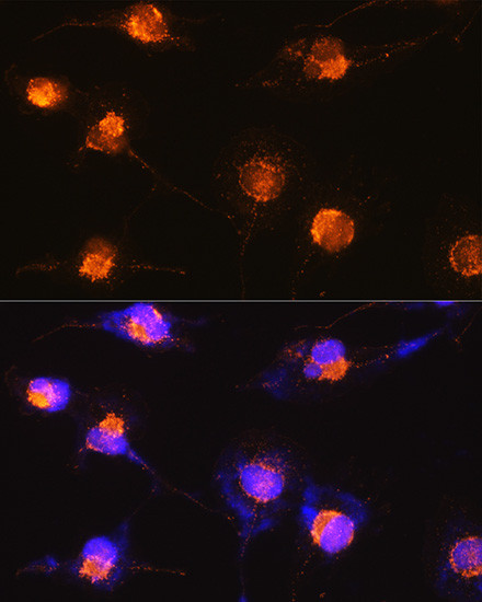 S100B Antibody in Immunocytochemistry (ICC/IF)