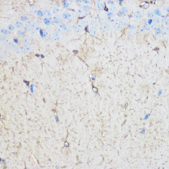 S100B Antibody in Immunohistochemistry (Paraffin) (IHC (P))