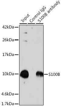 S100B Antibody in Immunoprecipitation (IP)