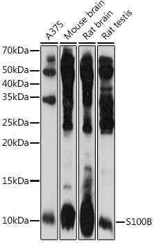 S100B Antibody in Western Blot (WB)