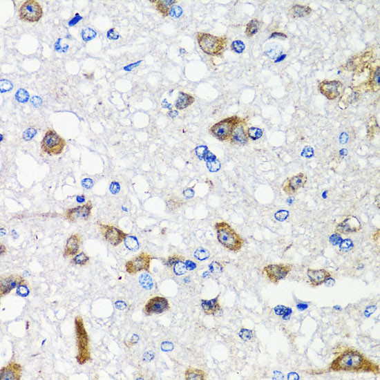 ACVR1C Antibody in Immunohistochemistry (Paraffin) (IHC (P))