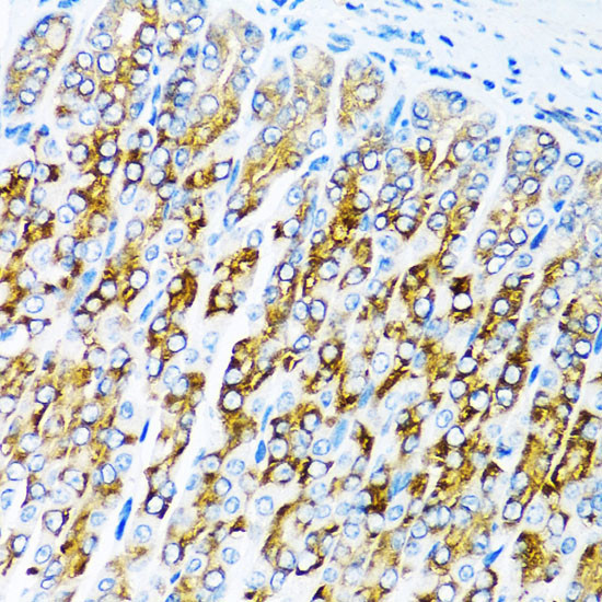 ACVR1C Antibody in Immunohistochemistry (Paraffin) (IHC (P))