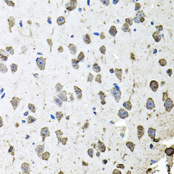 FGF1 Antibody in Immunohistochemistry (Paraffin) (IHC (P))