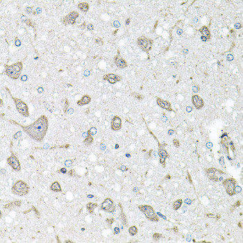 FGF1 Antibody in Immunohistochemistry (Paraffin) (IHC (P))