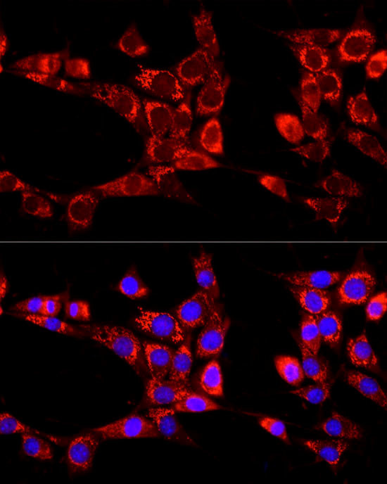 ATG13 Antibody in Immunocytochemistry (ICC/IF)