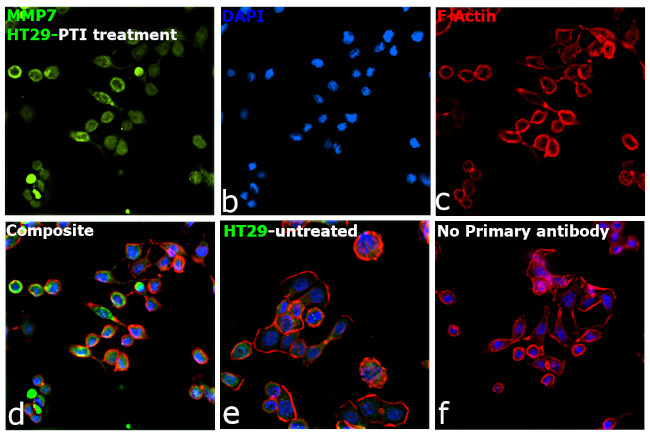 MMP7 Antibody in Immunocytochemistry (ICC/IF)