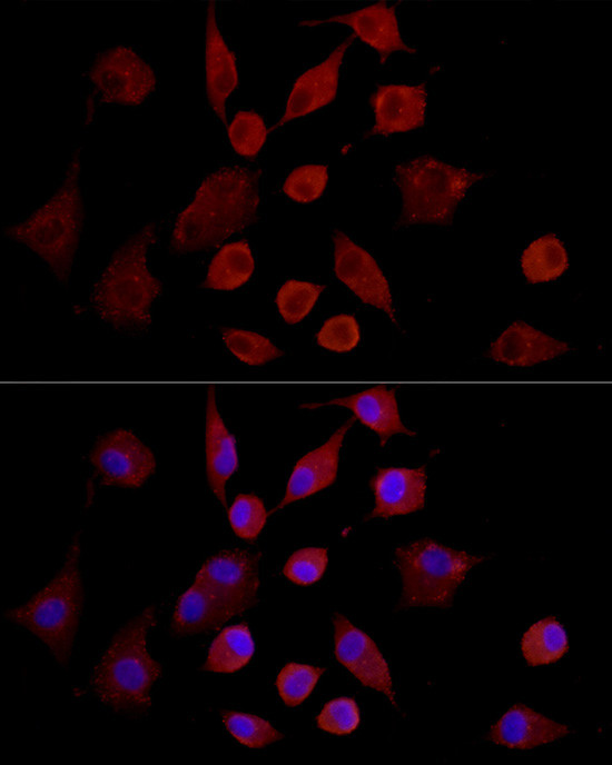 MMP7 Antibody in Immunocytochemistry (ICC/IF)