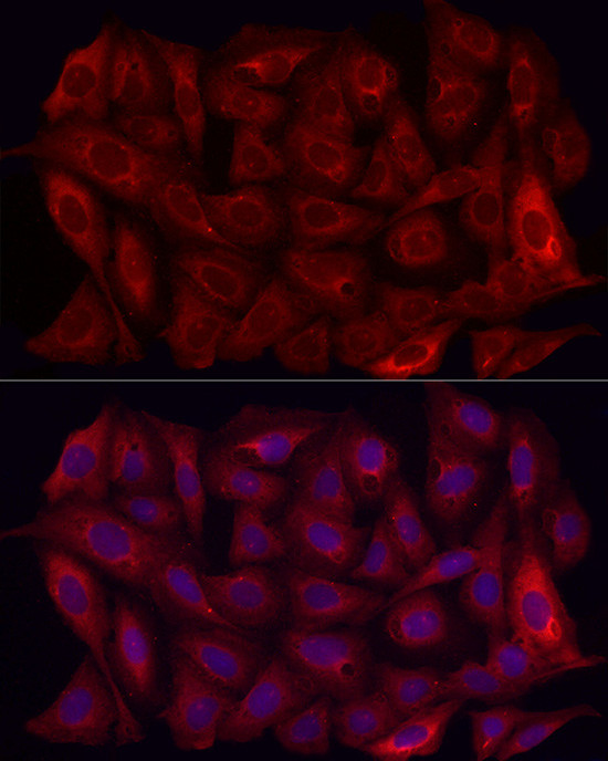 MMP7 Antibody in Immunocytochemistry (ICC/IF)