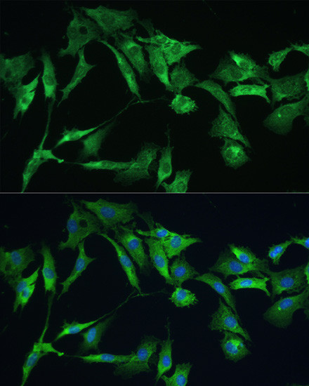 Ezrin Antibody in Immunocytochemistry (ICC/IF)