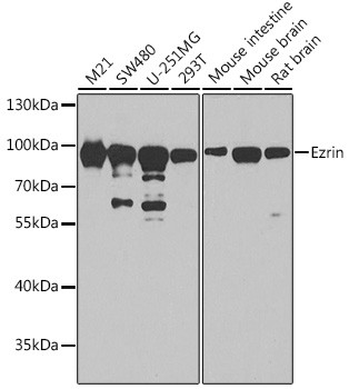 Ezrin Antibody in Western Blot (WB)