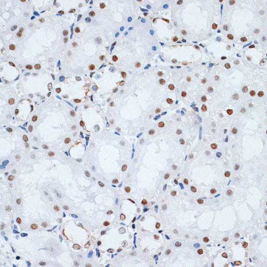 HMGB1 Antibody in Immunohistochemistry (Paraffin) (IHC (P))