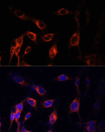 TSC1 Antibody in Immunocytochemistry (ICC/IF)