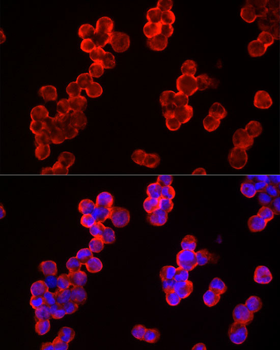 c-Cbl Antibody in Immunocytochemistry (ICC/IF)