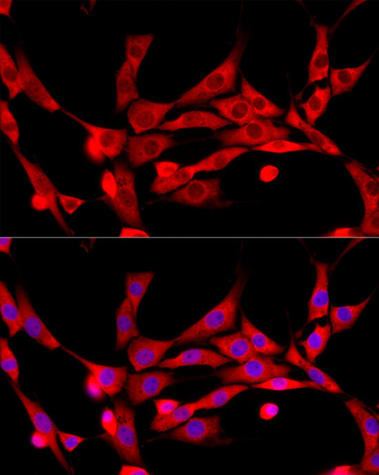 c-Cbl Antibody in Immunocytochemistry (ICC/IF)