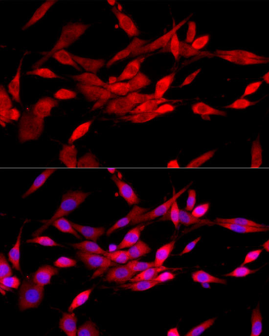 c-Cbl Antibody in Immunocytochemistry (ICC/IF)