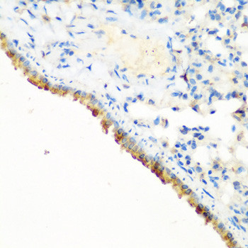 c-Cbl Antibody in Immunohistochemistry (Paraffin) (IHC (P))