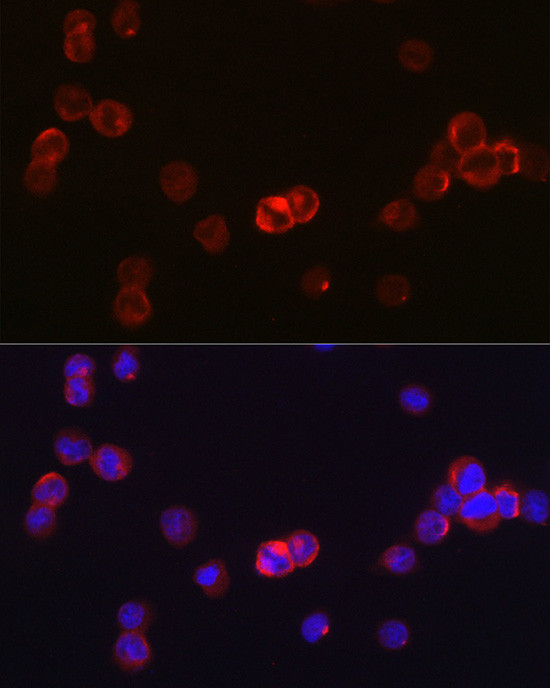 JAK3 Antibody in Immunocytochemistry (ICC/IF)