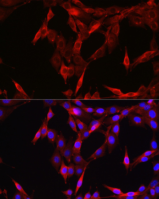 STAT6 Antibody in Immunocytochemistry (ICC/IF)