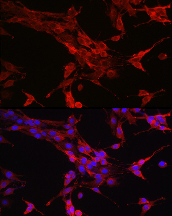 STAT6 Antibody in Immunocytochemistry (ICC/IF)