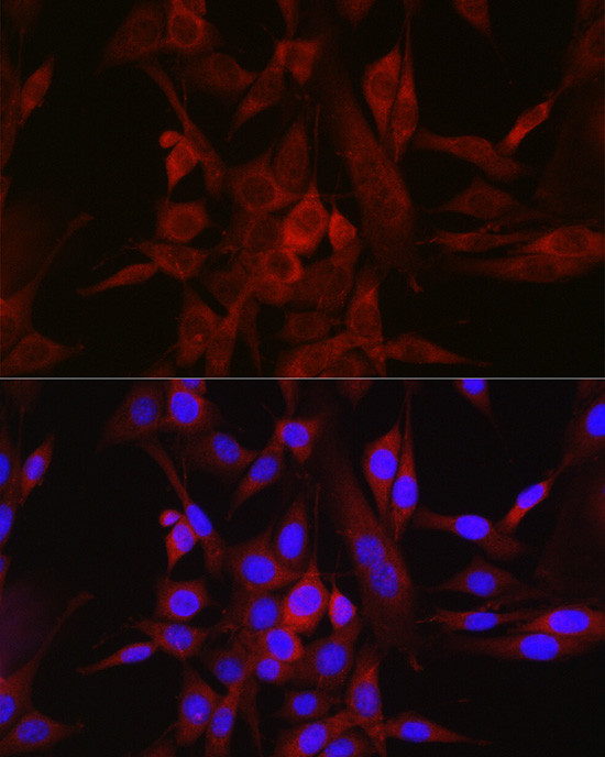 STAT6 Antibody in Immunocytochemistry (ICC/IF)