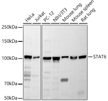 STAT6 Antibody in Western Blot (WB)