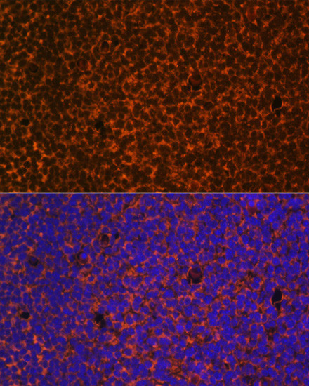 PTCH Antibody in Immunocytochemistry (ICC/IF)