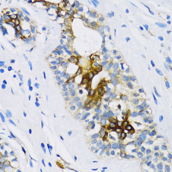 PTCH Antibody in Immunohistochemistry (Paraffin) (IHC (P))