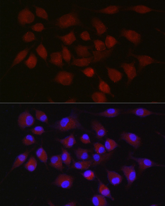 cIAP2 Antibody in Immunocytochemistry (ICC/IF)