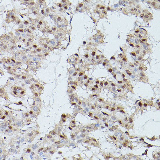 CDK9 Antibody in Immunohistochemistry (Paraffin) (IHC (P))