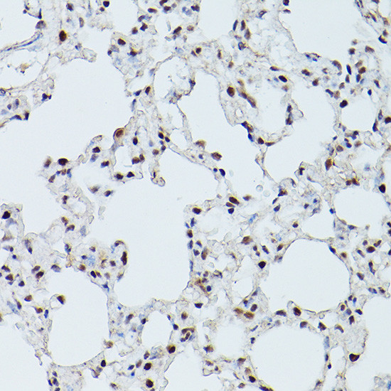 CDK9 Antibody in Immunohistochemistry (Paraffin) (IHC (P))