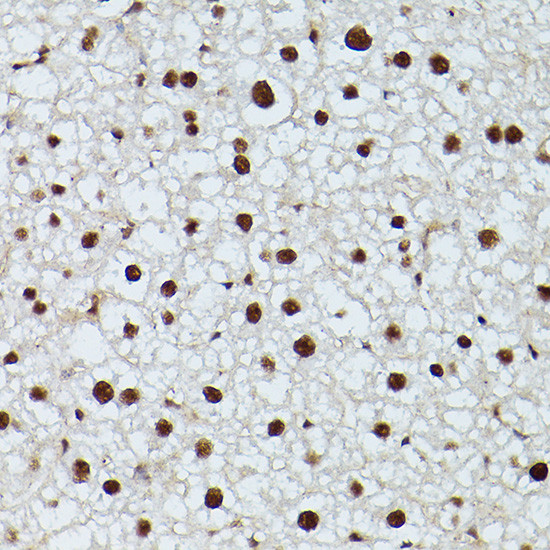 CDK9 Antibody in Immunohistochemistry (Paraffin) (IHC (P))