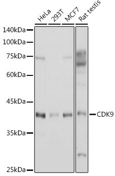 CDK9 Antibody in Western Blot (WB)