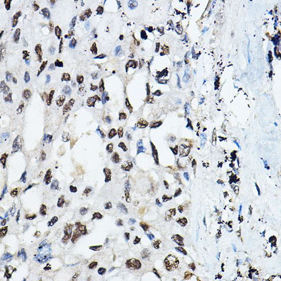 C/EBP alpha Antibody in Immunohistochemistry (Paraffin) (IHC (P))