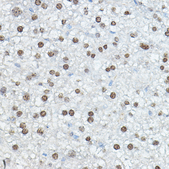 C/EBP alpha Antibody in Immunohistochemistry (Paraffin) (IHC (P))