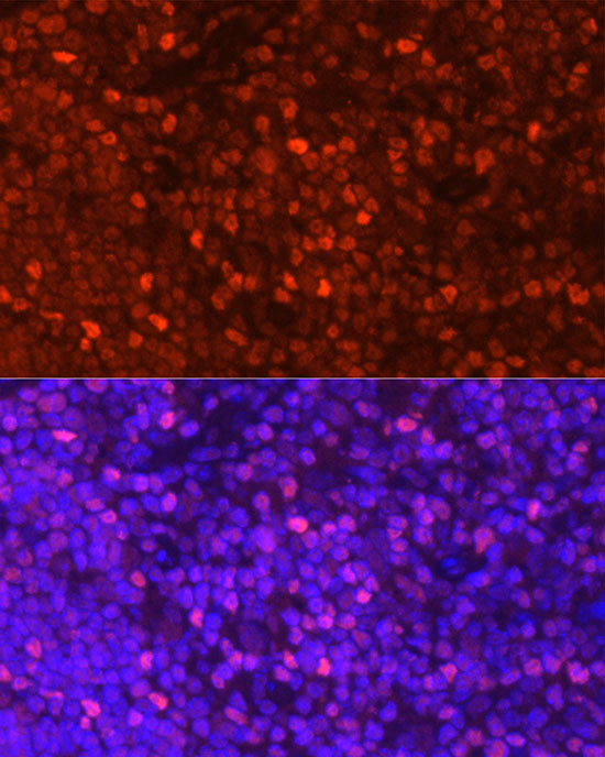 LEF1 Antibody in Immunocytochemistry (ICC/IF)