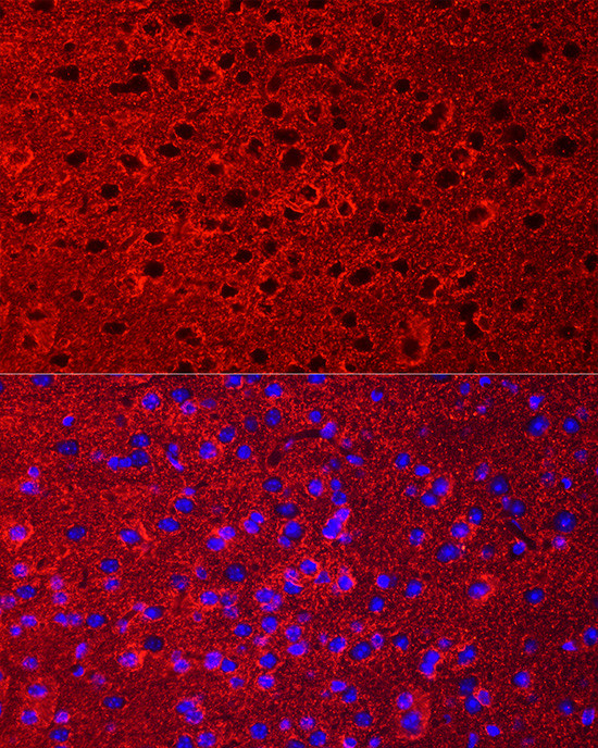 GLT-1 Antibody in Immunocytochemistry (ICC/IF)