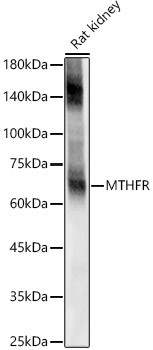 GLT-1 Antibody in Western Blot (WB)