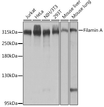 Filamin A Antibody in Western Blot (WB)
