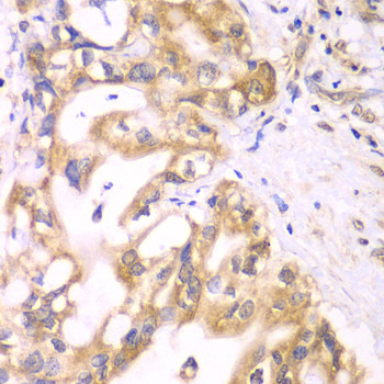 ACADS Antibody in Immunohistochemistry (Paraffin) (IHC (P))