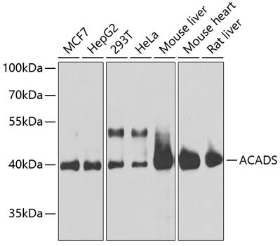 ACADS Antibody in Western Blot (WB)