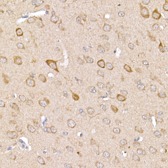 TRAF2 Antibody in Immunohistochemistry (Paraffin) (IHC (P))