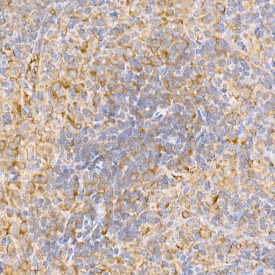 TRAF2 Antibody in Immunohistochemistry (Paraffin) (IHC (P))