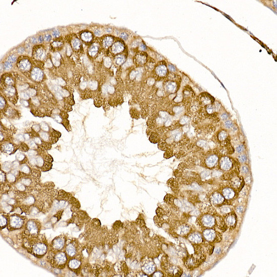 TRAF2 Antibody in Immunohistochemistry (Paraffin) (IHC (P))